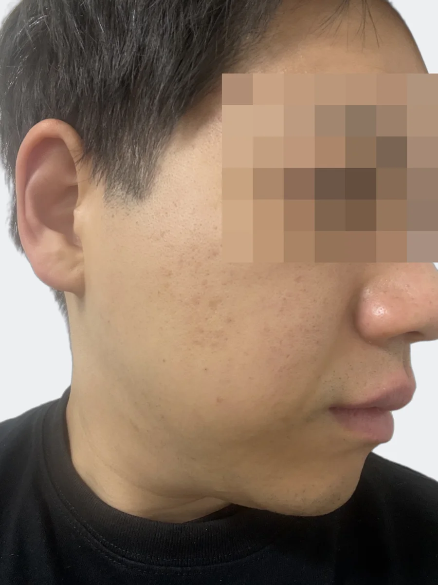 2月28日の右頬