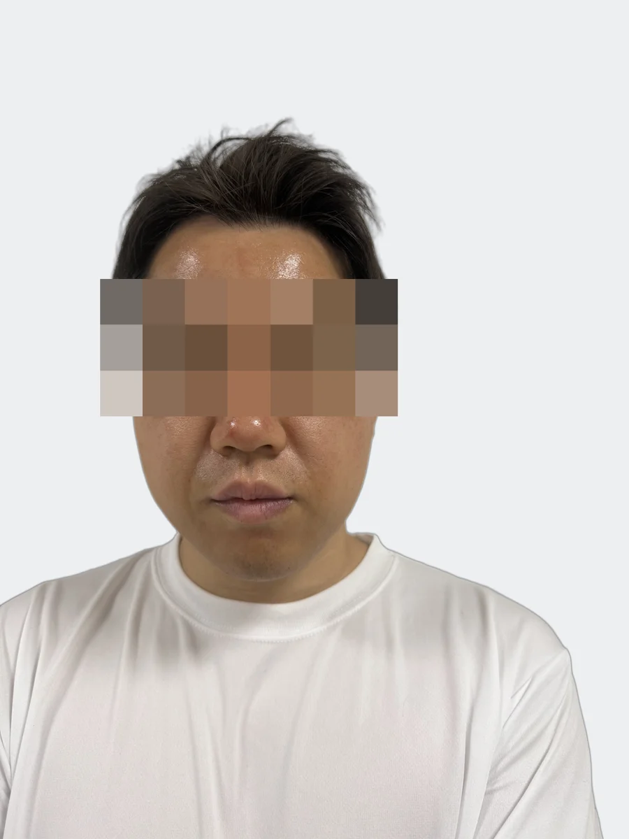 14時間後の正面