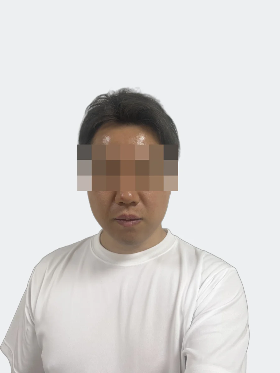 24時間後の正面