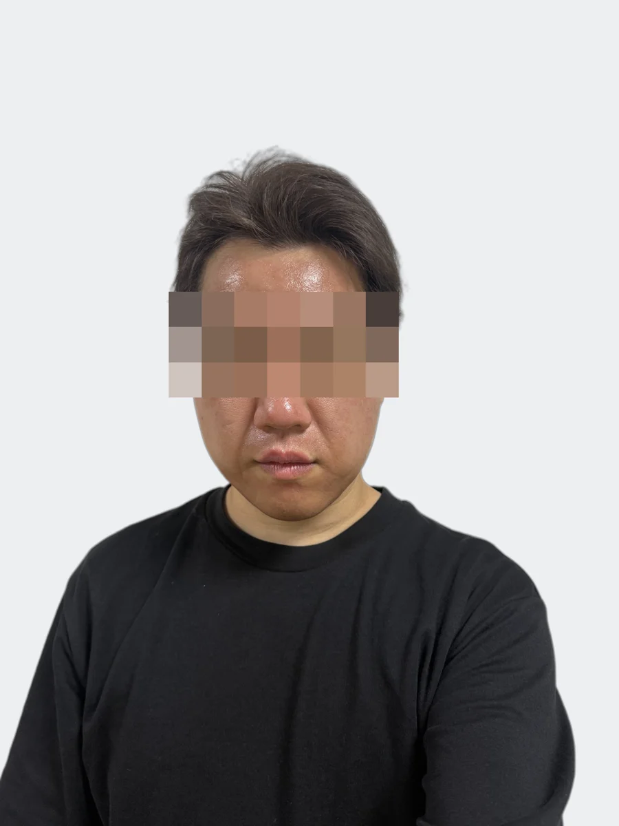 30分後の正面