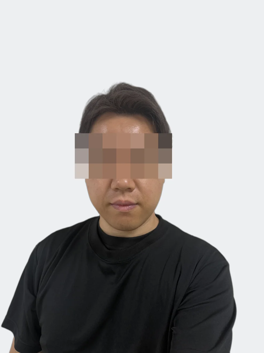 36時間後の正面