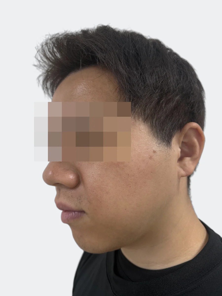 36時間後の斜めから