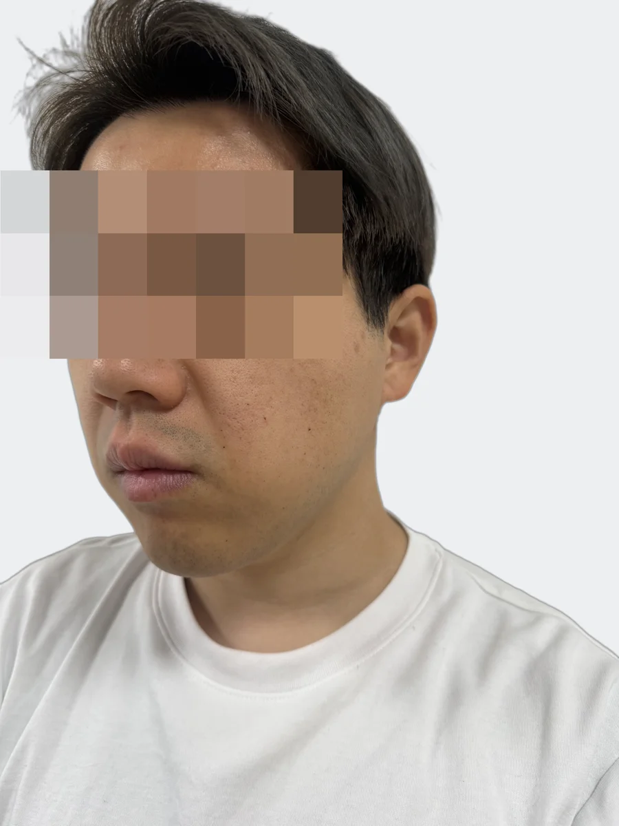 24時間後の顔