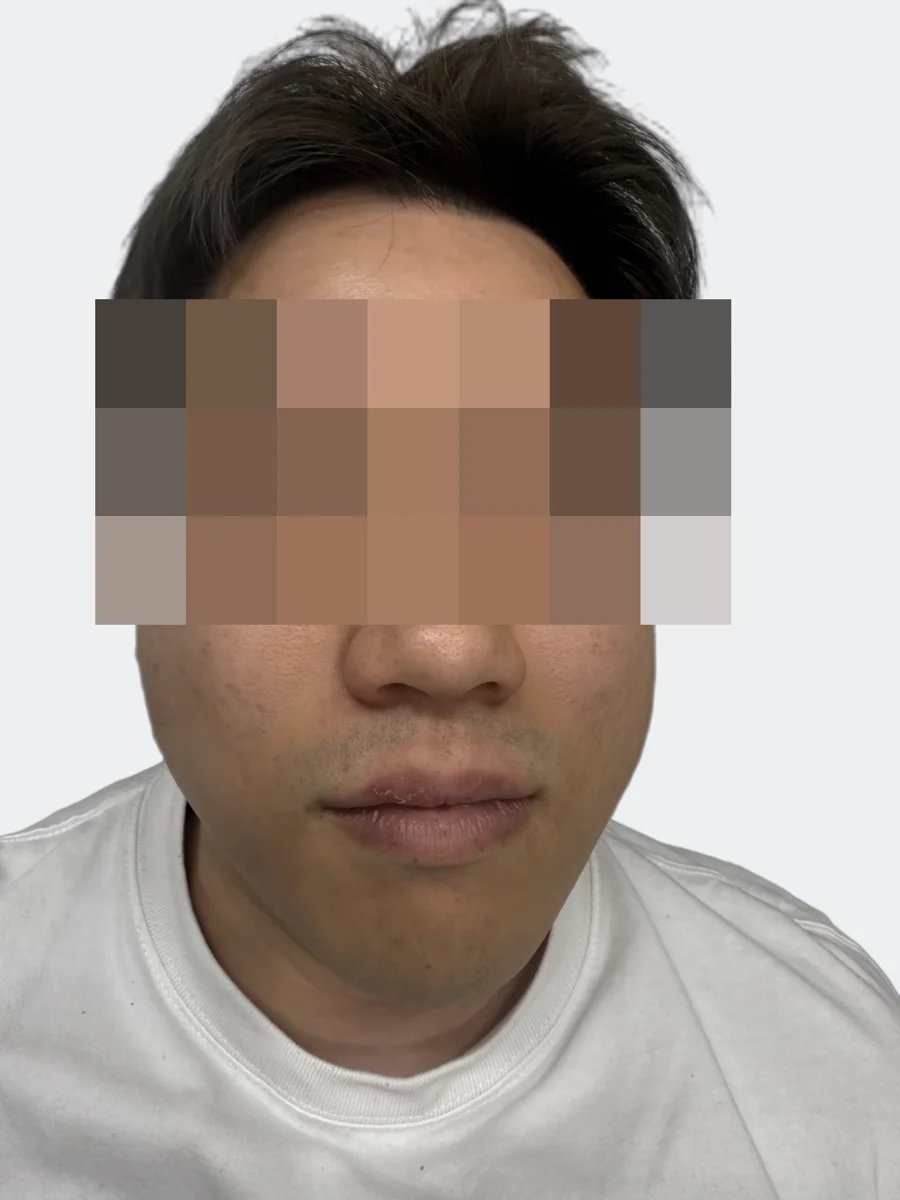 クリニックで施術前に撮った顔
