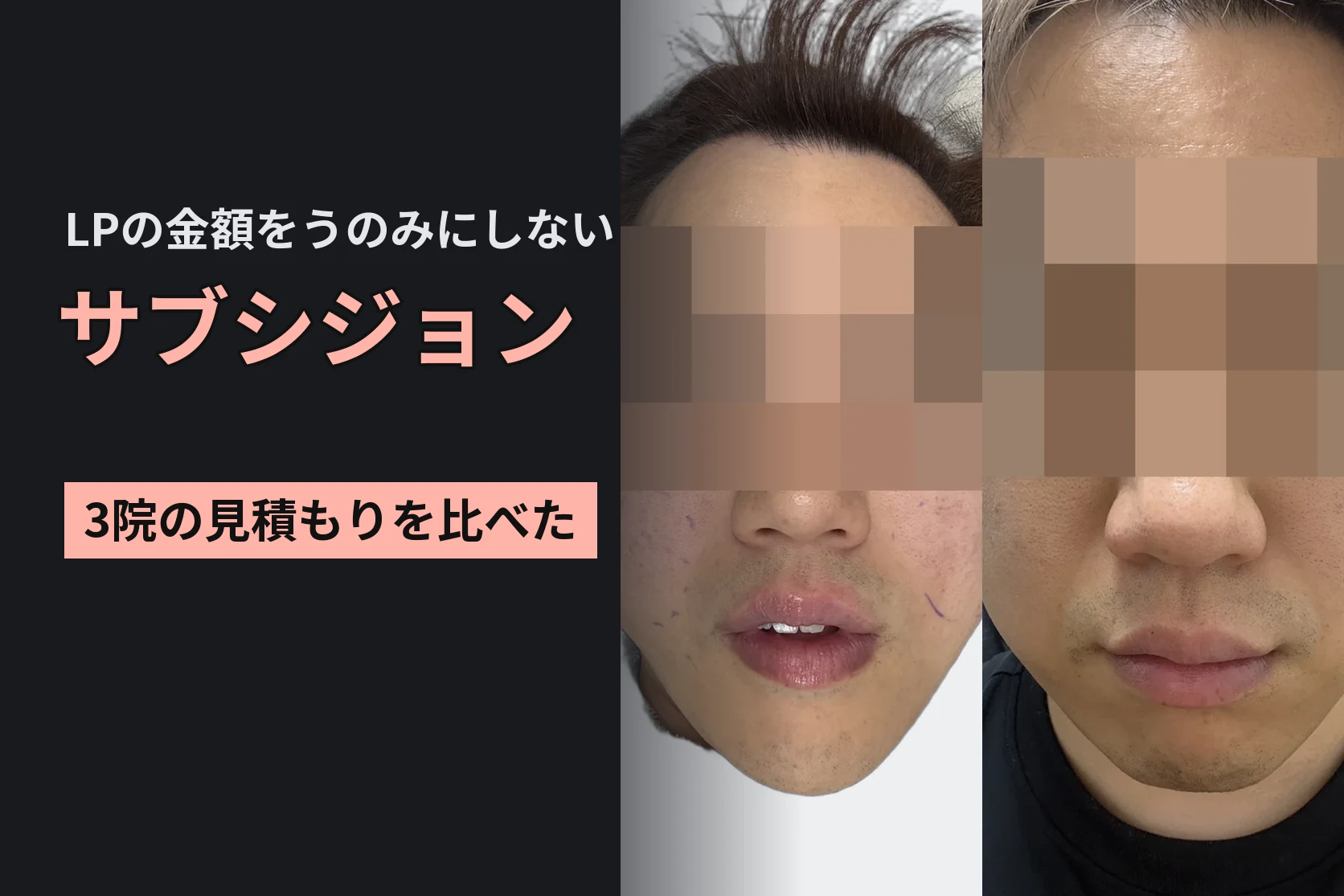サブシジョンはLPの金額をうのみにしないで。3院の見積もりを比べて両頬を受けた